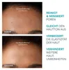 FOREO KIWI Gesichtspflegegerät für Porenreinigung – Sanftes Produktbild-Vorschau 4