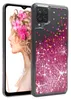 A phone case with a glittery pink and gold star design is shown next to a profile of a woman with pink flowers in her hair. Produktbild-Vorschau