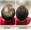 Color One Streuhaar Dunkelbraun 25g – Sofort Produktbild-Vorschau 7