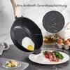 Just Perfecto JL-32: Set di 13 pezzi di pentole in granito Produktbild-Vorschau 16