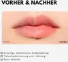 VT Cosmetics Reedle Shot Lip Plumper Expert – Produktbild-Vorschau 4