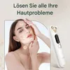 Mitesserentferner mit 5 Modi & 4 Saugspitzen, Elektrischer Produktbild-Vorschau 2