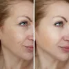 DR. OEZGOEREN KOSMETIK - HYALURON CREME & Q10 - Anti-Aging, Produktbild-Vorschau 6