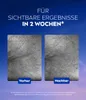 A marketing image showing a before and after comparison of skin treatment. Náhľad obrázku produktu