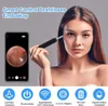 Ohrenreiniger, Ohrenschmalz-Entferner Otoskop mit Wifi, 6 Produktbild-Vorschau 2