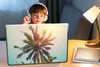 MuchoWow® Laptop Aufkleber Sticker Cover Palme - Sommer - Produktbild-Vorschau 3