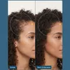 ShinyHair Haarwuchsbooster - Nahrungsergänzungsmittel gegen Produktbild-Vorschau 8