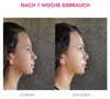 FOREO BEAR Smartes Mikrostrom-Gesichtsgerät zur Straffung & Produktbild-Vorschau 4