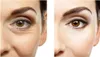 Augen-Massagegerät, Mikro-Vibrations Produktbild-Vorschau 5