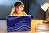 MuchoWow® Laptop Aufkleber Sticker Cover Glitter - Achat Produktbild-Vorschau 3