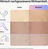 IPL odstraňovač chĺpkov IPL Skin i-expert PL7253 s Náhľad obrázku produktu 21