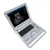 Échographe portable avec sonde linéaire Doppler couleur Voir les images du produit 11