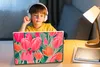 MuchoWow® Laptop Aufkleber Sticker Cover Tulpen - Blumen - Produktbild-Vorschau 3