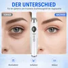5-stufiger Augenpflegestift – Hochfrequenz-Vibration & Produktbild-Vorschau 2