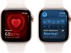 Apple Watch Series 10 GPS + Cellular 42mm Rose Gold Produktbild-Vorschau 6