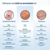 A comparison of different types of warts, with images and descriptions. Náhľad obrázku produktu
