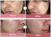 Medicube PDRN Pink Peptide Serum 30 ml Náhled obrázku produktu 17