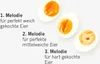 Brainstream PiepEi Elvis Ei Eierkocher Frühstücksei Ei Eier Produktbild-Vorschau 3