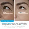 Good4You – LED Gesichtsmaske – LED Lichttherapie Produktbild-Vorschau 11