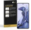 4x 9H Panzerglas für Xiaomi 11T Schutzglas Displayschutz Produktbild-Vorschau 2
