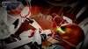 Metroid Dread  (SWITCH) Podgląd zdjęcia produktu 9