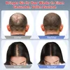 Laser-Haarkappe, rotes Anti-Haarausfall-Licht, 4 Modi (660 Produktbild-Vorschau 3