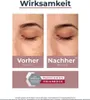 Eucerin Anti-Pigment Nacht Cream, 50 ml Krém Náhľad obrázku produktu 17