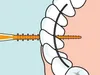 An illustration showing how to use an interdental brush to clean between teeth and around braces. Produktbild-Vorschau