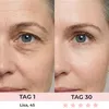 LED-oogmasker met roodlicht- en microstroomtherapie – Productafbeelding-voorbeeld 5