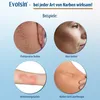 Four circular images showing different types of scars with German text labels. Náhled obrázku produktu