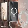 EAZY CASE - Handykette kompatibel mit Apple iPhone 15 Plus Produktbild-Vorschau 3
