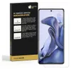 A product box for a screen protector is shown next to a smartphone with the screen protector applied. Produktbild-Vorschau