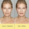 Schlangengift-Serum Produktbild-Vorschau 8