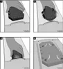 Four-panel illustration showing how to insert knee pads into trousers. Produktbild-Vorschau
