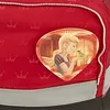 Ergobag Pack Küss den Bär Schulrucksack Set 6tlg. Produktbild-Vorschau 11
