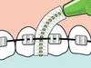 Illustration showing a close-up of teeth with braces, and an interdental brush being used to clean around the braces. Produktbild-Vorschau