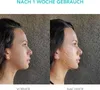 FOREO BEAR Smartes Mikrostrom-Gesichtsgerät zur Straffung & Produktbild-Vorschau 4