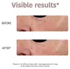 Iroha Nature Gold Patches Extra Firmness Eyes Produktbild-Vorschau 3