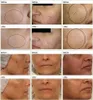 3 In 1 Gesicht CO2 Bubble Beauty Maschine Anti Falten Produktbild-Vorschau 8