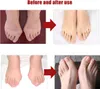 6x Silikon Soft-Gel Zehenspreizer, Zehentrenner für Hallux Produktbild-Vorschau 8