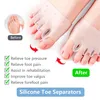 1 Paar Zehenspreizer Hallux Valgus Korrektur Vorfußpolster Produktbild-Vorschau 7