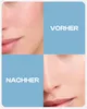 NUTRASKIN Vitamin C Serum - 30 ml Produktbild-Vorschau 6