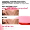 Gesichtsserum Serum für Gesicht Anua 10% Niacinamide TXA Produktbild-Vorschau 7