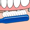 5x Tepe Zahnspangenbürste - Implant/Orthodontic Produktbild-Vorschau 5