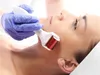 DERMA ROLLER 3-in-1 VERJÜNGENDE MESOTHERAPIE NADELMASSAGER Produktbild-Vorschau 3