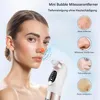 Porenreiniger Electric Mitesserentferner, Vakuum Cleaner 6 Produktbild-Vorschau 2