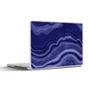 MuchoWow® Laptop Aufkleber Sticker Cover Glitter - Achat Produktbild-Vorschau 1