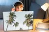 MuchoWow® Laptop Aufkleber Sticker Cover Palmen - Sommer - Produktbild-Vorschau 3
