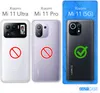 EAZY CASE Handykette kompatibel mit Xiaomi Mi 11 5G, Produktbild-Vorschau 7