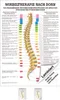 Dorntherapie Mini-Poster Anatomie 34x24 cm medizinische Produktbild-Vorschau 1